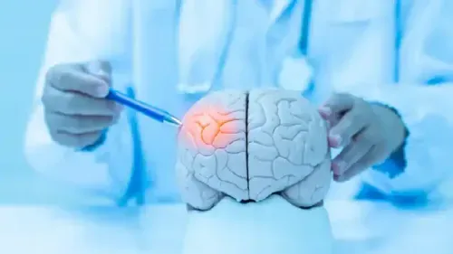 Mild Stroke Symptoms and Their Treatment